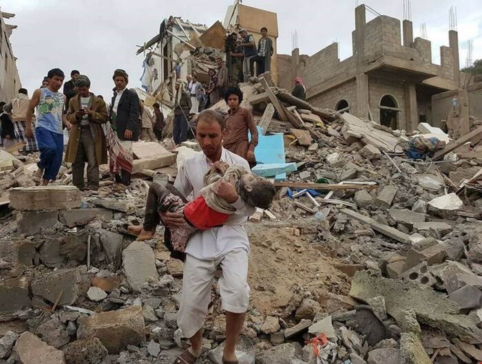 الأمم المتحدة تؤكد مقتل 215 مدني في اليمن خلال الثلاثة الأشهر الماضية