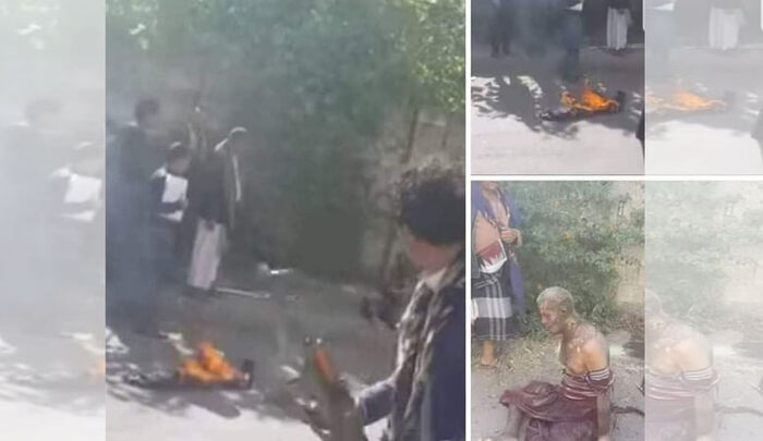 مواطن يفارق الحياة بعد إحراق نفسه بسبب ظلم الحوثي لأسرته