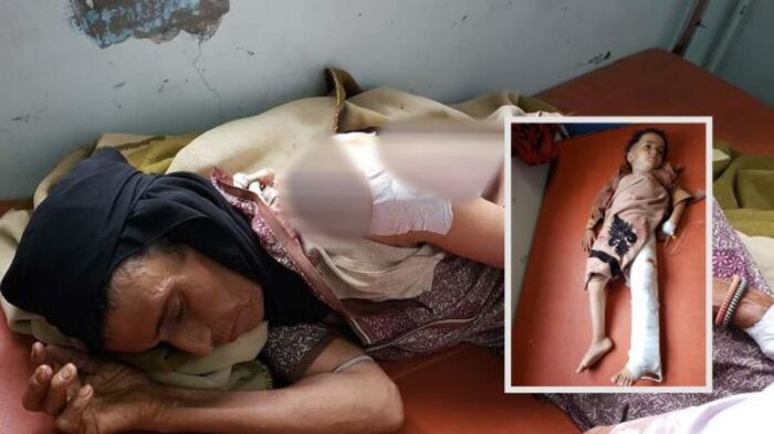 إصابة 4 أشخاص في عمليتي قنص وقصف للحوثيين بتعز