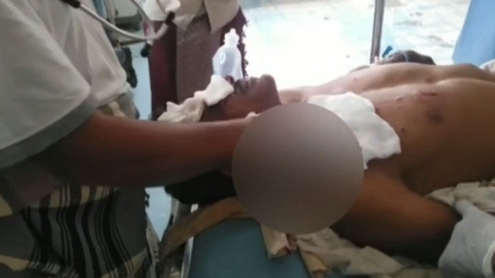 إصابة مزارع واعطاب حراثته بانفجار لغم حوثي بمديرية حيس
