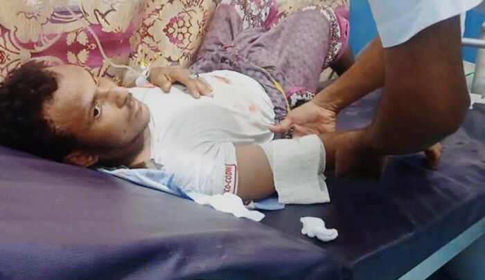 إصابة مواطن بنيران مليشيا الحوثي في مدينة حيس غربي اليمن