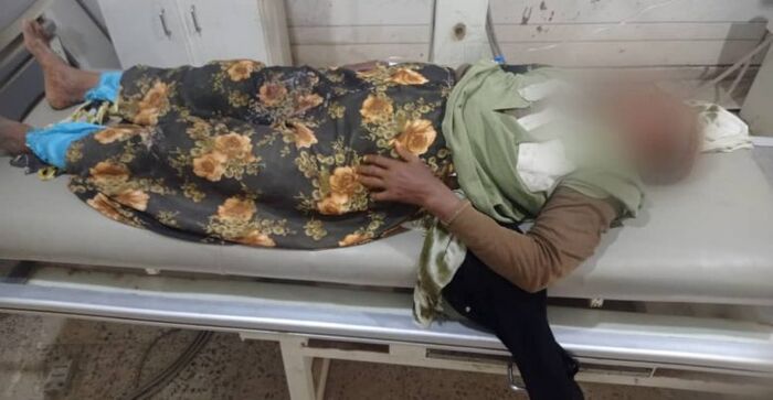 إصابة مسنة من أهالي حيس جنوب الحديدة برصاص مليشيا الحوثي