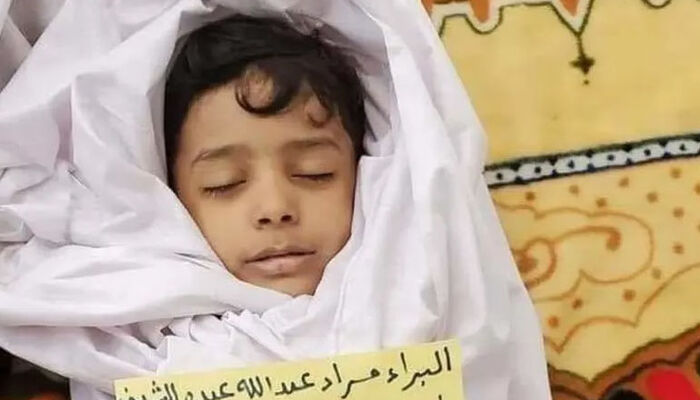 وفاة طفل وإصابة 12 آخرين بقصف إرهابي حوثي على تعز