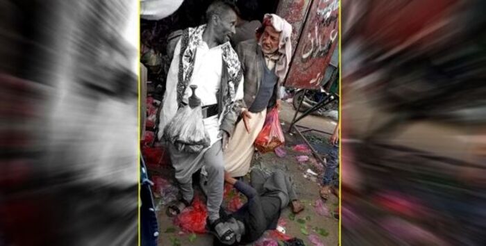 إب.. قيادي حوثي يتفاخر بوضع قدمه على رأس مواطن مصاب بحالة نفسية